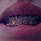 Onlyfans leak bracesfetish 

 profile picture
